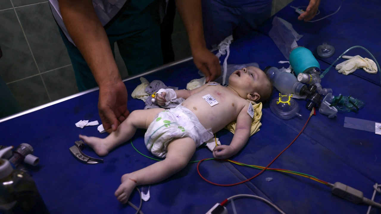 Medics treat a baby in a hospital following Israeli airstrikes in Rafah, southern Gaza Strip. /Said Khatib/AFP