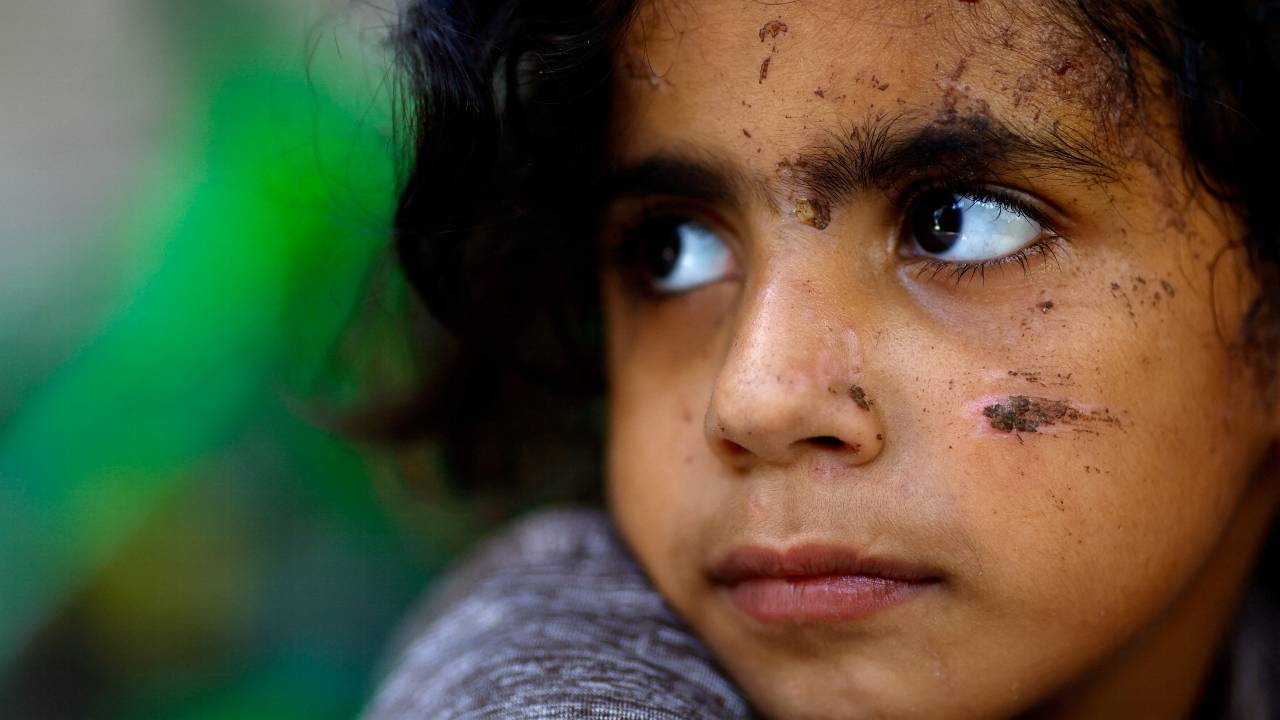 A Palestinian girl, one of the few survivors of Allamdani family, who fled to southern Gaza Strip to avoid Israeli airstrikes in Gaza City and settled in a shelter which was later hit by Israeli jets that killed 13 of her relatives. /Mohammed Salem/Reuters