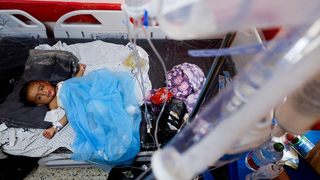 Wateen, a 14 months old Palestinian who was injured in an Israeli strike which killed her mother and injured her twin brother Ahmed, rests at Nasser hospital, in Khan Younis, Gaza. /Mohammed Salem/Reuters