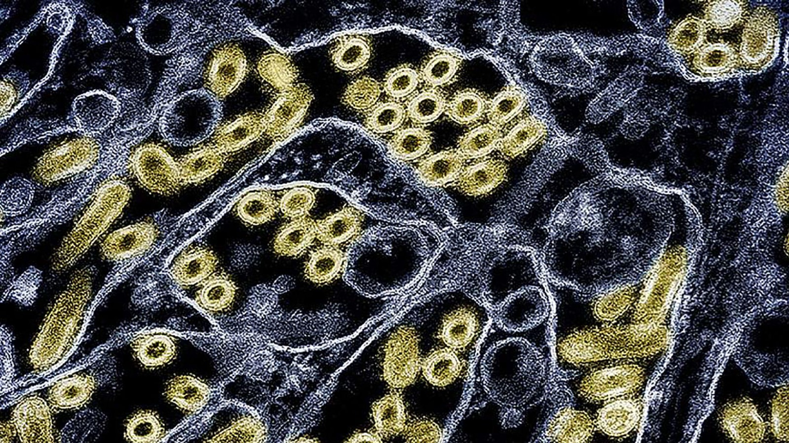 Colorized transmission electron micrograph of avian influenza A H5N1 virus particles (gold), grown in Madin-Darby Canine Kidney (MDCK) epithelial cells. /CDC and NIAID/AFP
