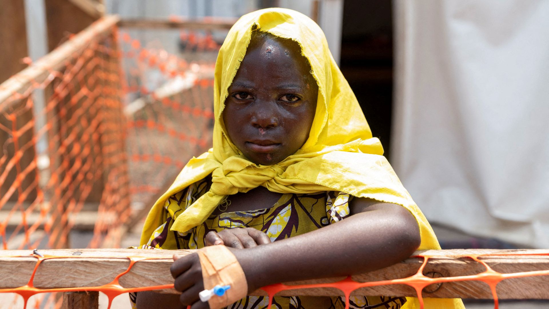 A newly arrived patient awaits consultation at the treatment centre for Mpox in Munigi. /Arlette Bashizi/Reuters