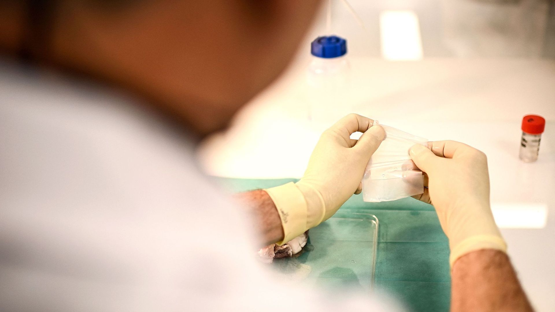 France is in the midst of a medical crisis. /Christophe Archambaulyt via CFP