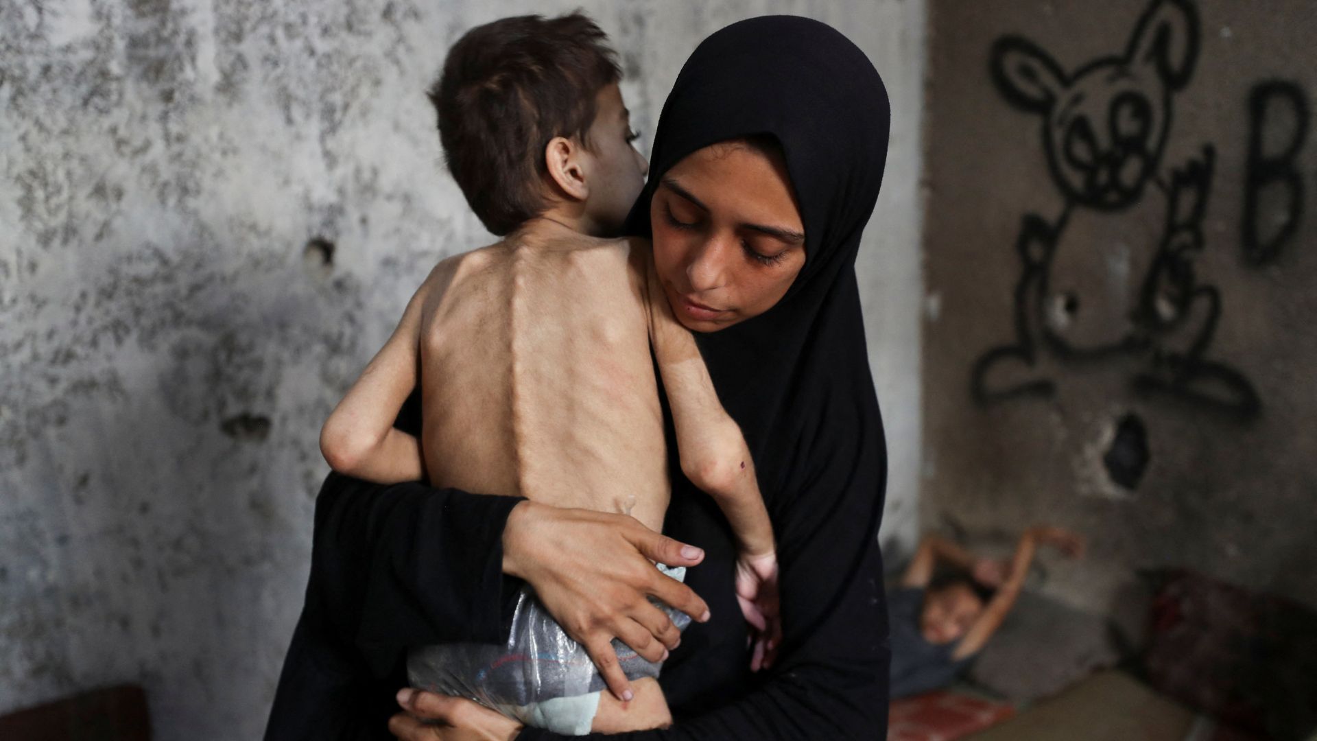The war inside the bodies of Gaza's children