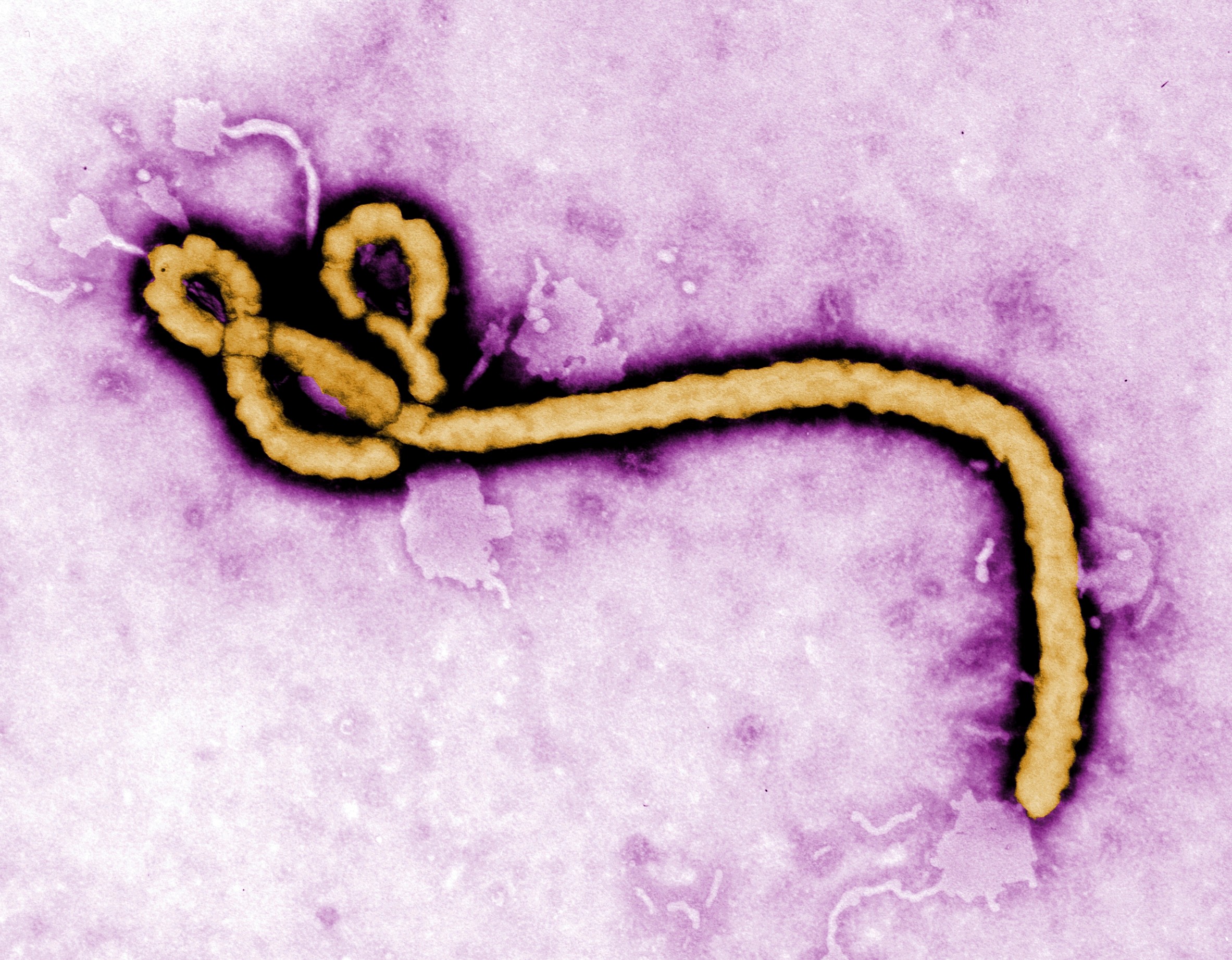 The outbreak remained undetected for at least a few weeks since the first death. /Frederick Murphy/CDC via AP