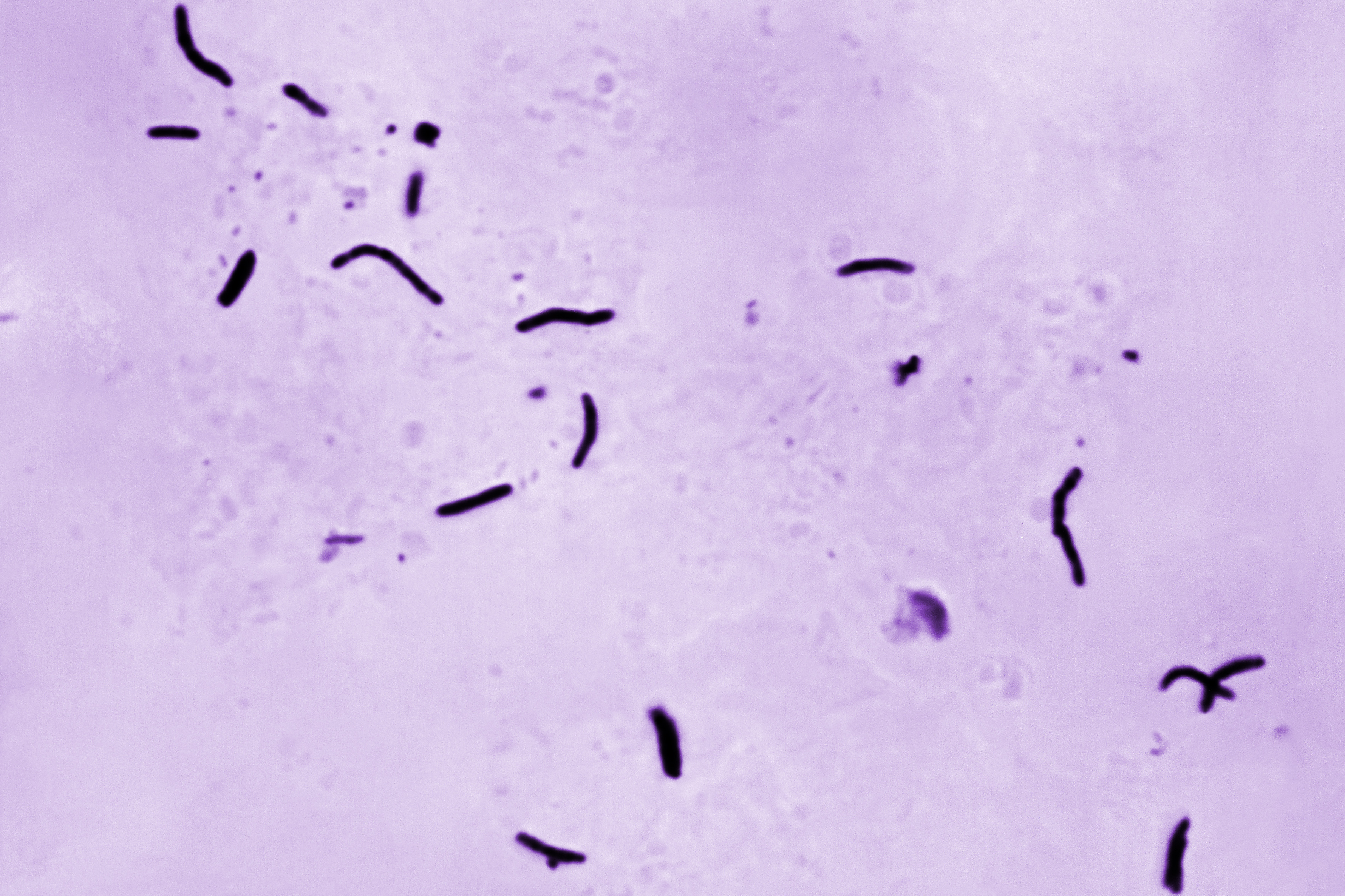 Tuberculosis claims approximately 1.23 million lives worldwide each year is particularly worrying because it already spreads through the air. /Elizabeth S. Mingioli/CDC via AP