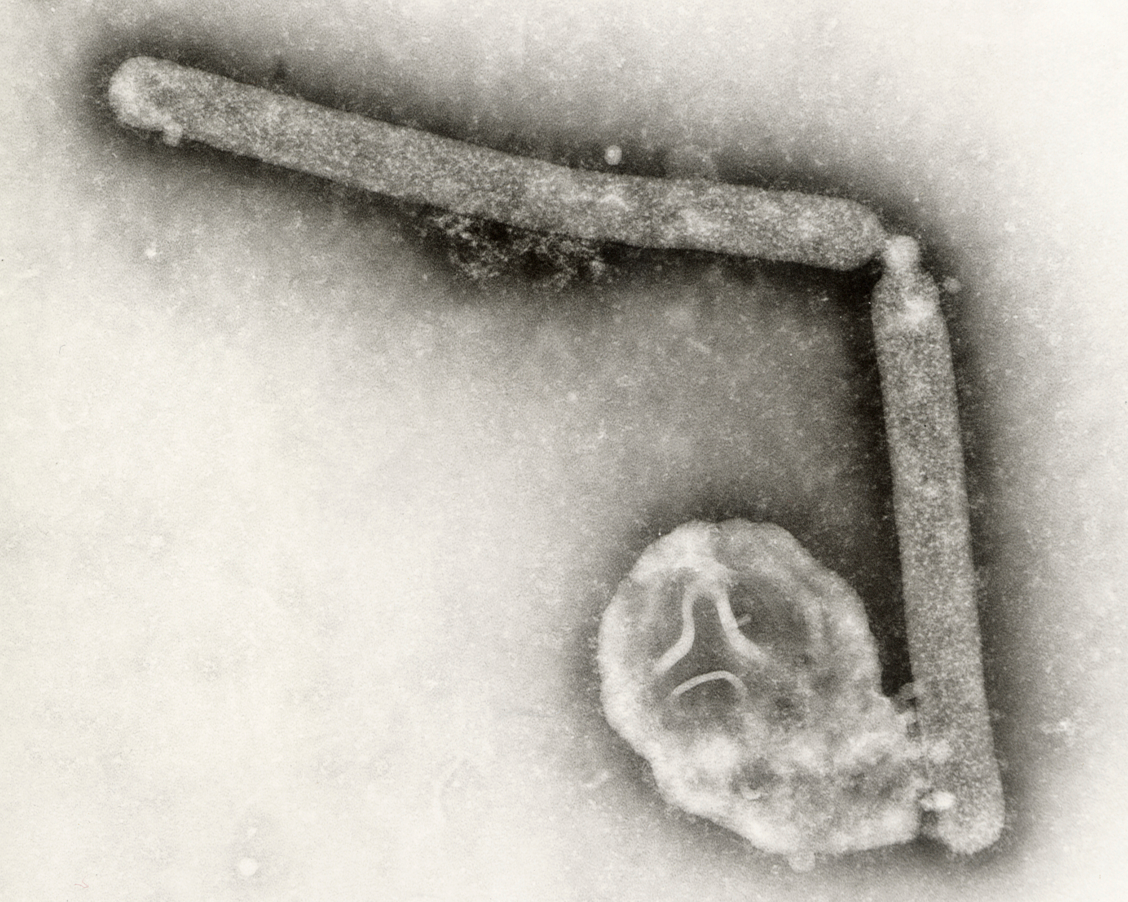 H5N1 is especially alarming because human cases have shown mortality rates far higher than seasonal influenza. /Cynthia Goldsmith, Jackie Katz/CDC via AP